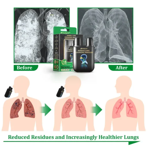 Alisanda™ Herbal Lung Cleansing Inhaler