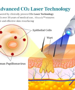 Alisanda™ LumeSkin Mole and Wart Removal Laser Pen