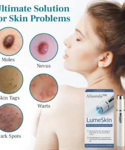 Alisanda™ LumeSkin Mole and Wart Removal Laser Pen