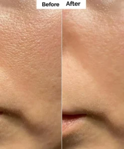 Alisanda™ Pore & Spot Care Duo| Shrinks Pores & Fades Blemish Marks