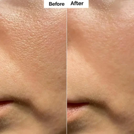 Alisanda™ Pore & Spot Care Duo| Shrinks Pores & Fades Blemish Marks