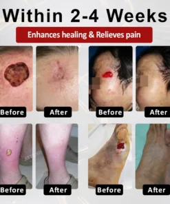 ALISANDA® GlucoseGuard Skin Rescue Cream