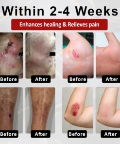 ALISANDA® GlucoseGuard Skin Rescue Cream