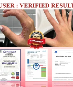 ALISANDA® GlucoseGuard Skin Rescue Cream