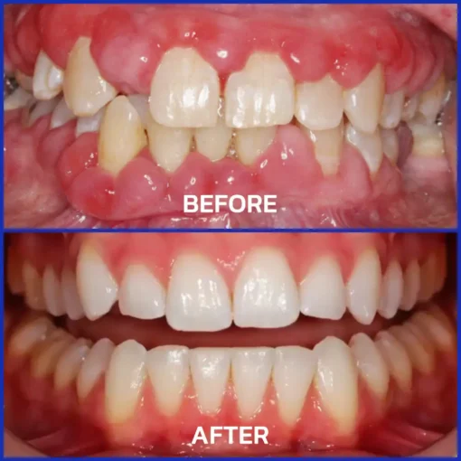 Alisanda® VioGloss Bee Venom Dental Therapy Oral Power