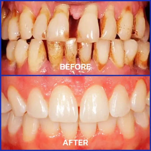 Alisanda® VioGloss Bee Venom Dental Therapy Oral Power