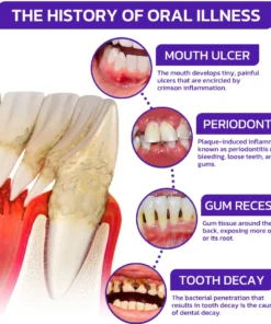 Alisanda® VioGloss Bee Venom Dental Therapy Oral Power