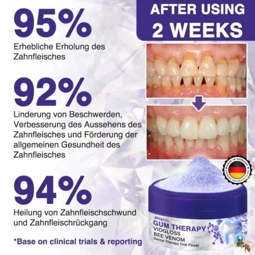 Alisanda® VioGloss Bee Venom Dental Therapy Oral Power
