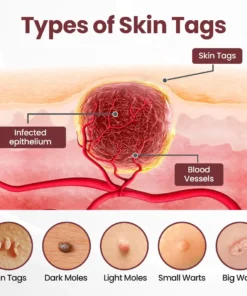 Alisanda® Dual-Action Renewal Cream