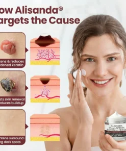Alisanda® Dual-Action Renewal Cream