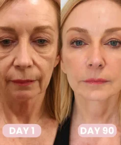 Alisanda™ GLP-1 Patches