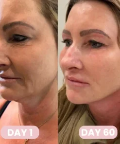 Alisanda™ GLP-1 Patches