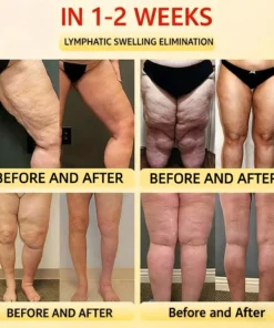 Alisanda™ Self-regulating tourmaline shaping shorts with titanium fiber