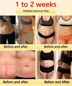 Alisanda™ Self-regulating tourmaline shaping shorts with titanium fiber