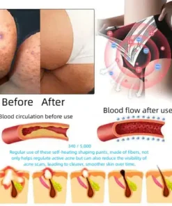 Alisanda™ Self-regulating tourmaline shaping shorts with titanium fiber