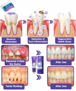 Alisanda® Bee Venom Dental Treatment Toothpaste