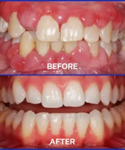 Alisanda® Bee Venom Dental Treatment Toothpaste