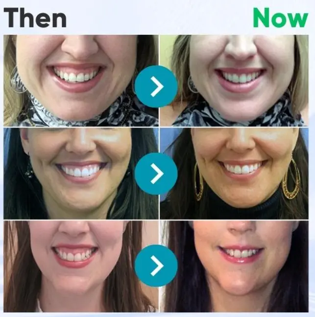 Alisanda® Bee Venom Dental Treatment Toothpaste