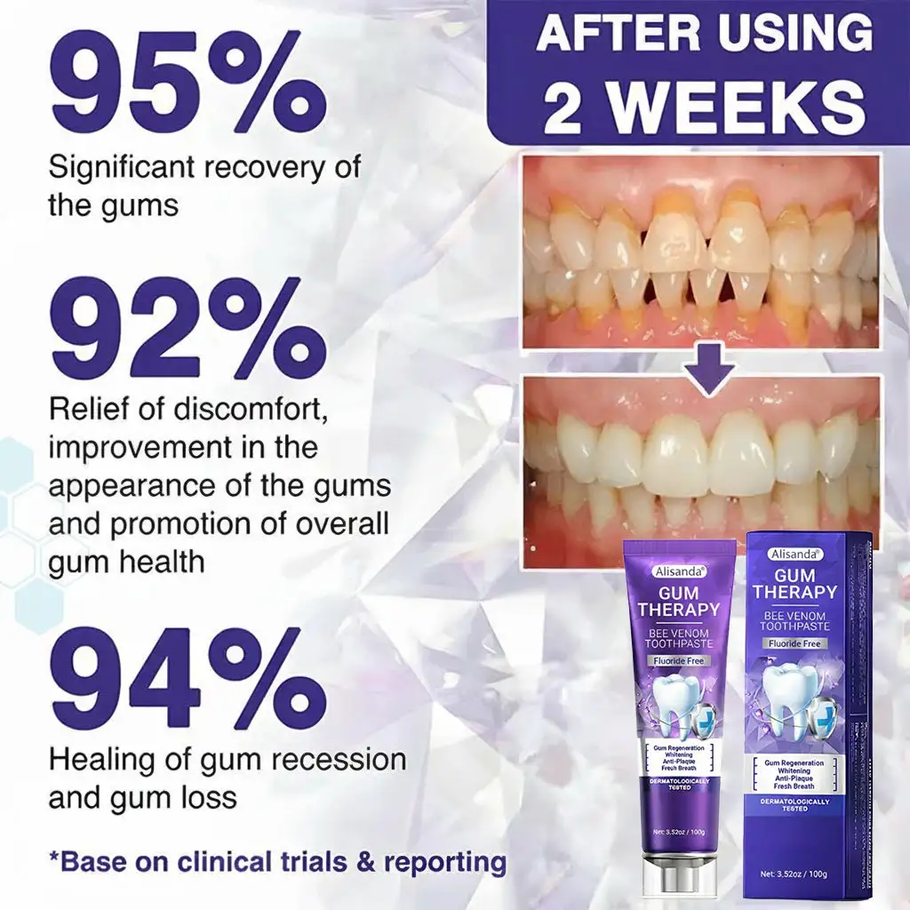 Alisanda® Bee Venom Dental Treatment Toothpaste