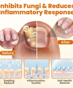 Alisanda® FungiBee Advanced Nail Repair Spray