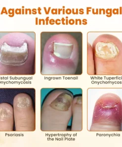 Alisanda® FungiBee Advanced Nail Repair Spray