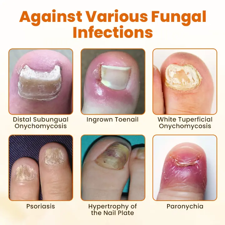 Alisanda® FungiBee Advanced Nail Repair Spray