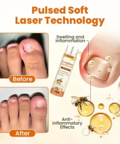 Alisanda® FungiBee Advanced Nail Repair Spray