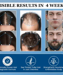 Alisanda® Hair Growth Roll on Serum