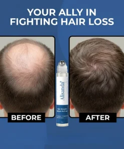 Alisanda® Hair Growth Roll on Serum