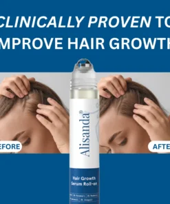 Alisanda® Hair Growth Roll on Serum