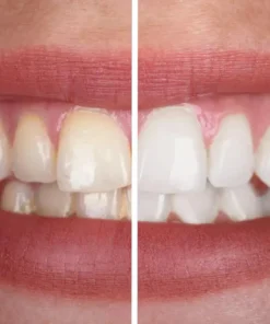 Alisanda® PurpleWhite Toothplaste