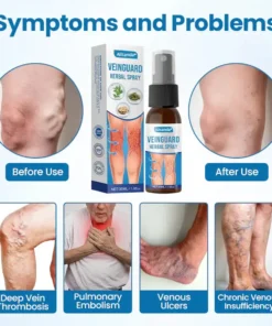 Alisanda® VeinGuard Herbal Spray