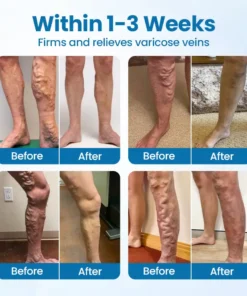 Alisanda® VeinGuard Herbal Spray