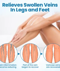 Alisanda® VeinGuard Herbal Spray