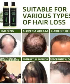 Alisanda® Organic Rosemary Hair Growth Shampoo