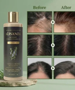 Alisanda® Rosemary Shampoo Now Upgraded for Superior Hair Growth