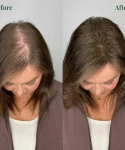 Alisanda® Rosemary Shampoo Now Upgraded for Superior Hair Growth