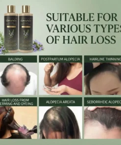 Alisanda® Rosemary Shampoo Now Upgraded for Superior Hair Growth