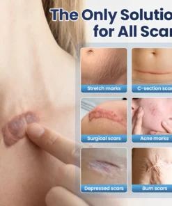 Alisanda® Texture Repair Gel