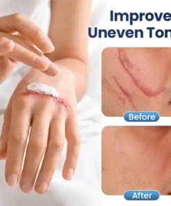 Alisanda® Texture Repair Gel