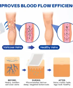 Alisanda® 𝑽𝗲𝗶𝙣 𝘾𝐨𝐧𝘁𝗼𝙪𝙧 𝙈𝙞𝐜𝐫𝒐𝒏𝒆𝗲𝗱𝗹𝙚 𝙋𝙖𝐭𝐜𝒉