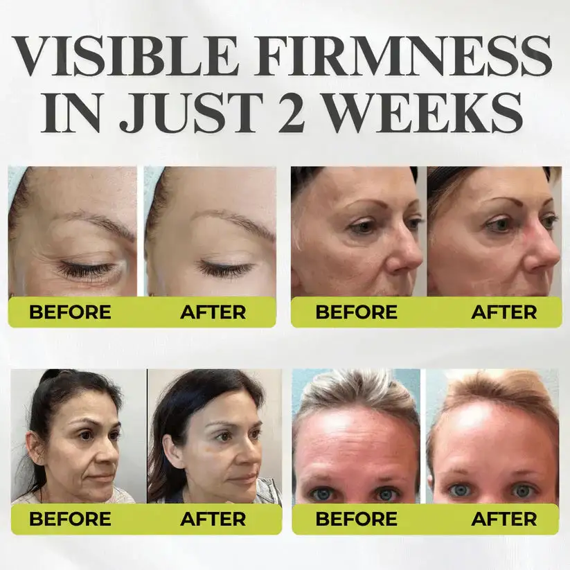 Alisanda® Advanced Peptide Botox-Style + Vita-A Retinol Lifting Renewal Cream