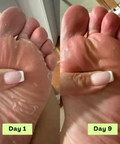 Alisanda™ - Antifungal Tea Tree Soap Bar