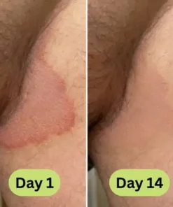 Alisanda™ - Antifungal Tea Tree Soap Bar