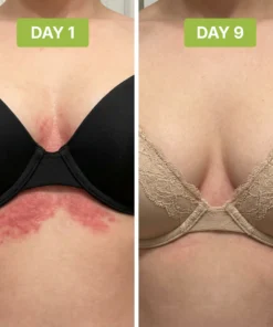 Alisanda™ - Antifungal Tea Tree Soap Bar