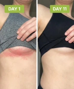 Alisanda™ - Antifungal Tea Tree Soap Bar