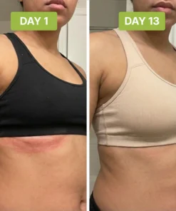 Alisanda™ - Antifungal Tea Tree Soap Bar