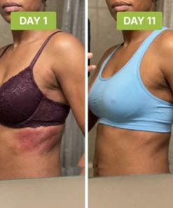 Alisanda™ - Antifungal Tea Tree Soap Bar