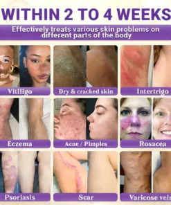 Alisanda® Biotin 10-in-1 Skin Restoration Cream