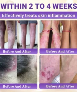 Alisanda® Biotin 10-in-1 Skin Restoration Cream